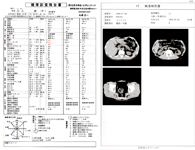 人間ドック審査結果CT写真付きのレポート