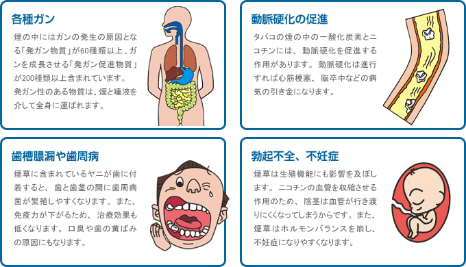 喫煙が与える影響（各種癌、動脈硬化の促進、歯槽膿漏や歯周病、勃起不全や不妊症）