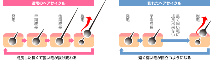 通常のヘアサイクルと乱れたヘアサイクル